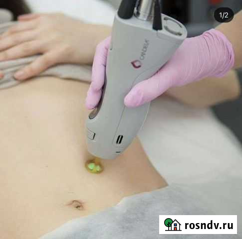 Adss fg 2000b для эпиляции Нижний Новгород - изображение 1