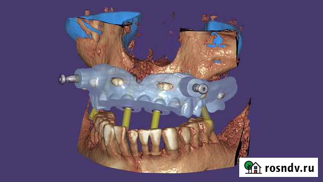 Exoplan 3.0 Full Version Волгоград - изображение 1