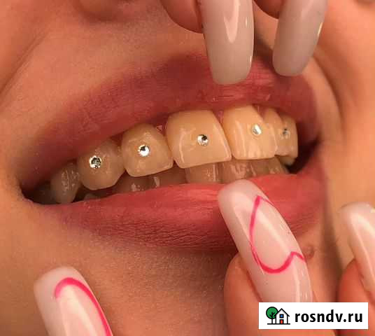 Скайсы Ростов-на-Дону - изображение 1