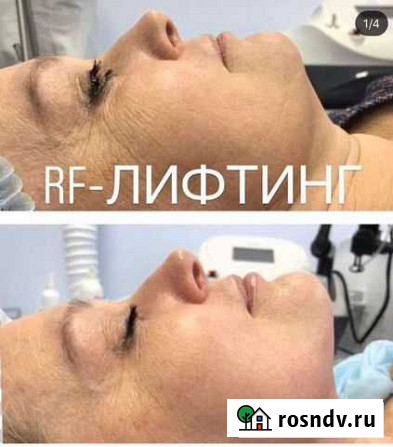 Косметология Ижевск - изображение 1