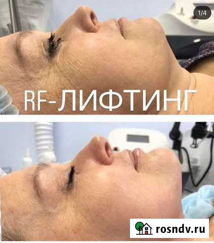 Косметология Ижевск - изображение 1