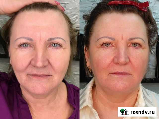 Массаж лица Кемерово - изображение 1