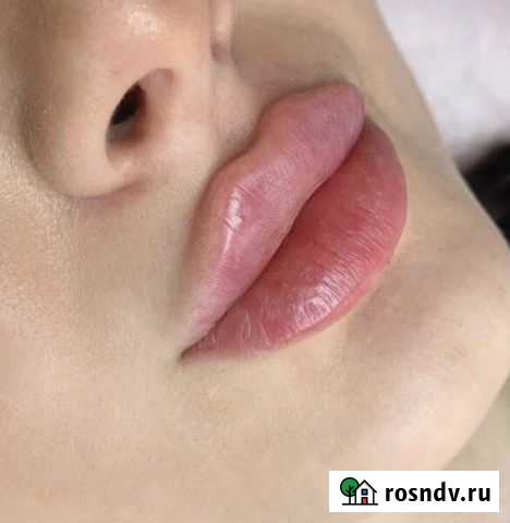 Косметолог Ростов-на-Дону - изображение 1