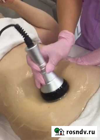 Кавитация и RF лифтинг, лазерный триполиз Саранск - изображение 1
