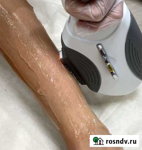 Салон лазерной эпиляции Казань - изображение 1