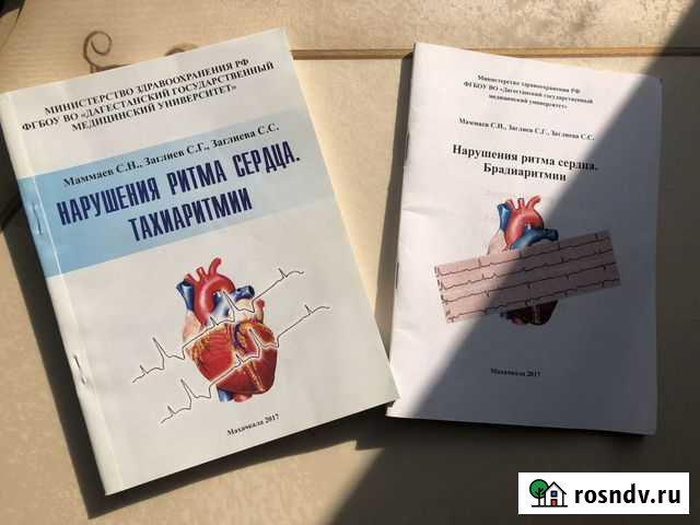 Методички нарушение ритма лор Махачкала - изображение 1