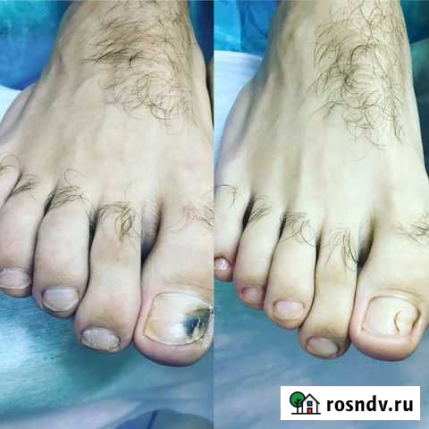 Мастер Парамедицинского Педикюра Нижний Новгород - изображение 1