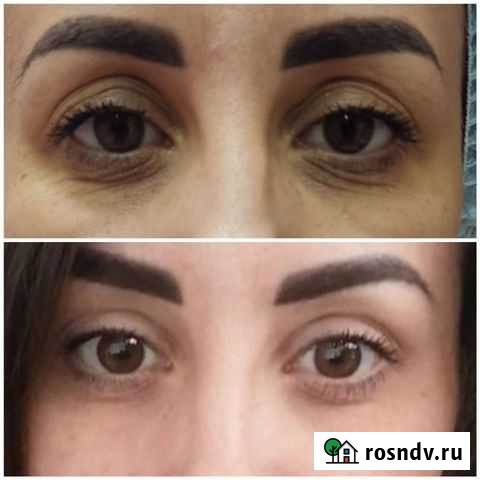 Косметолог Барнаул - изображение 1