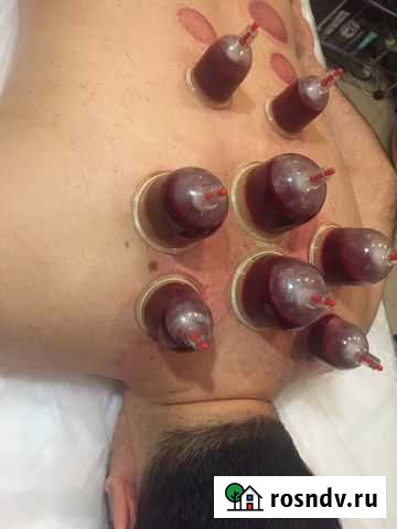 Хиджама обучение Москва - изображение 1