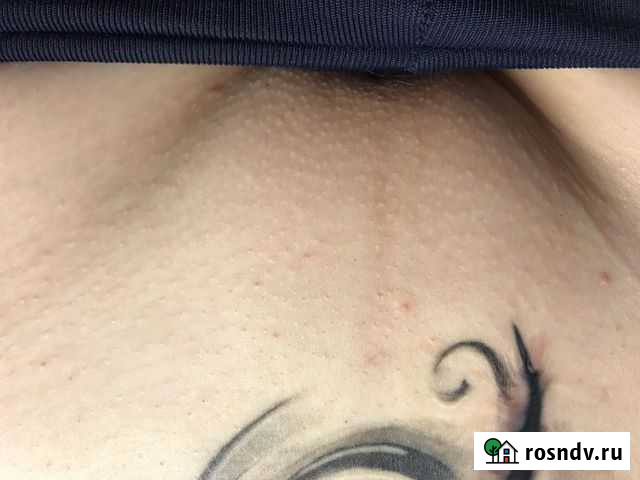 Электроэпиляция, шугаринг, spa-уход за лицом и тел Санкт-Петербург - изображение 1