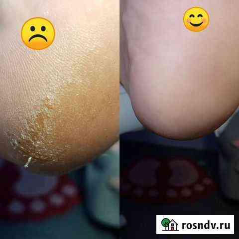 Мужской педикюр, женский, Косметический, лечебный Оренбург