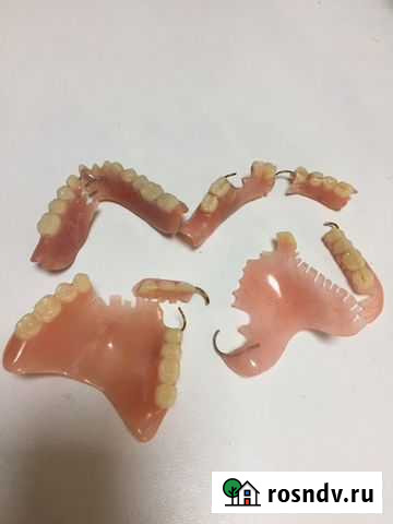 Ремонт зубных протезов Москва - изображение 1