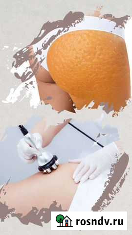 Вакуумный массаж, кавитация и RF-лица Старый Оскол - изображение 1