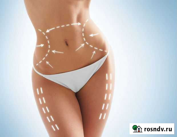 Массаж Vela Shape Кемерово - изображение 1