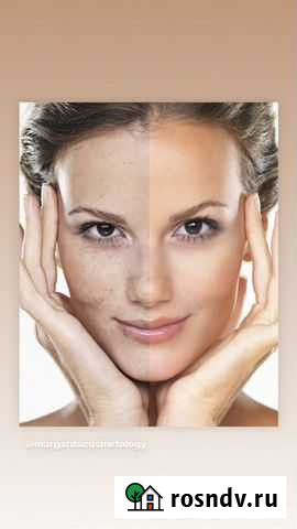 Косметолог чистка пилинг prx Ростов-на-Дону - изображение 1