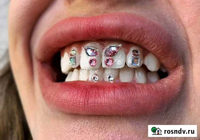 Скайсы стразы на зубы Белгород - изображение 1