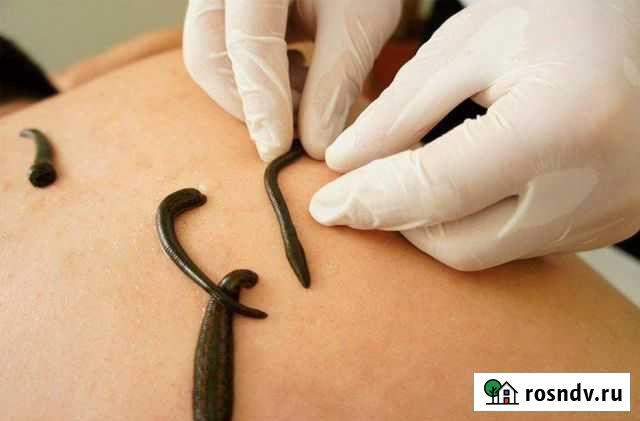 Пиявка медицинская Димитровград - изображение 1