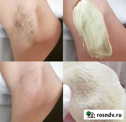 Современная депиляция Skins Елизово - изображение 1