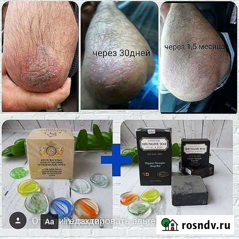 Крем для проблемной кожи Владимир - изображение 1