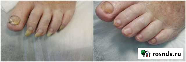 Педикюр Череповец - изображение 1