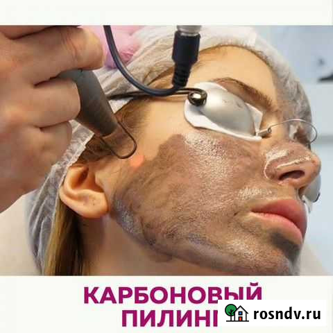 Карбоновый пилинг Нижний Новгород - изображение 1
