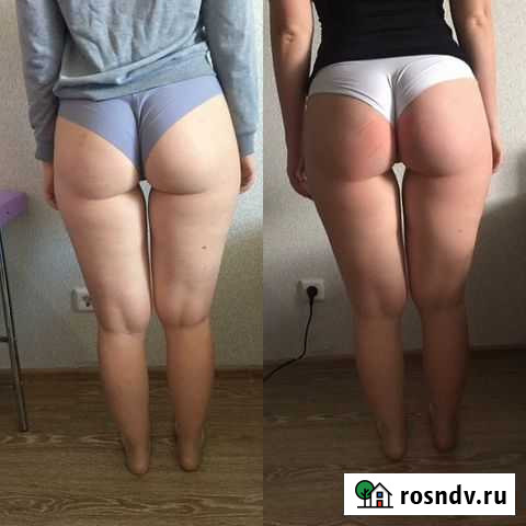 Pf лифтинг Екатеринбург - изображение 1