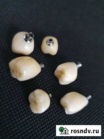 Протезирование Нижний Кисляй - изображение 1