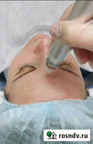 Чистка лица Белгород - изображение 1