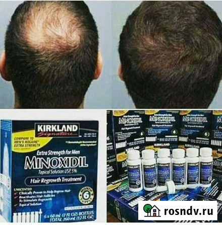 Миноксидил Набережные Челны - изображение 1