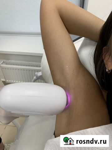 Лазерная эпиляция Екатеринбург - изображение 1