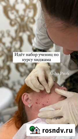 Обучение-Хиджама терапия Астрахань - изображение 1