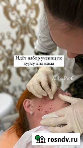 Обучение-Хиджама терапия Астрахань - изображение 1