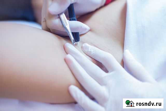 Электроэпиляция в Ачинске Ачинск - изображение 1