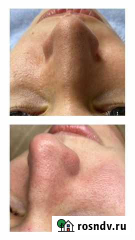 Косметолог чистка лица Пермь - изображение 1