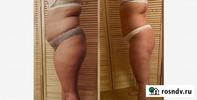 Антицеллюлитный массаж Волгоград - изображение 1