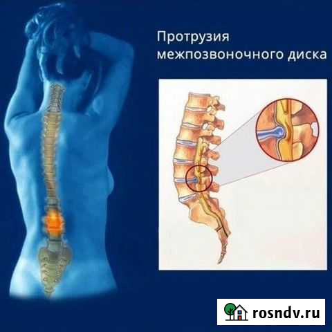 Массаж Новомосковск - изображение 1