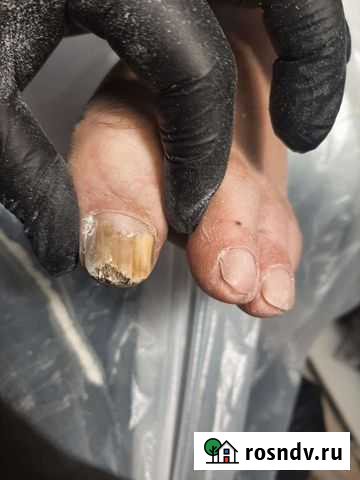 Педикюр парамедицинский Екатеринбург - изображение 1