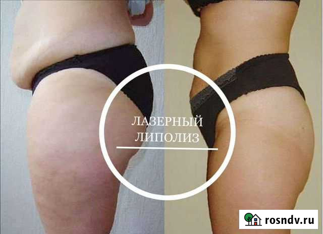 Услуги косметолога Новосибирск - изображение 1