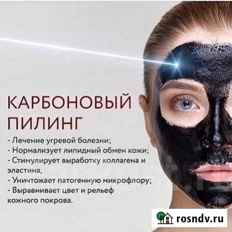 Карбоновый пилинг Петропавловск-Камчатский - изображение 1