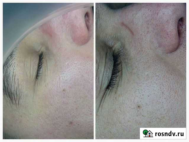 Услуги косметолога-эстетиста Нижневартовск - изображение 1