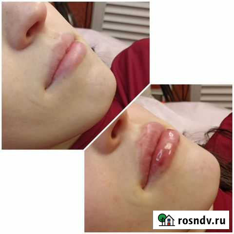 Услуги косметолога Курган - изображение 1