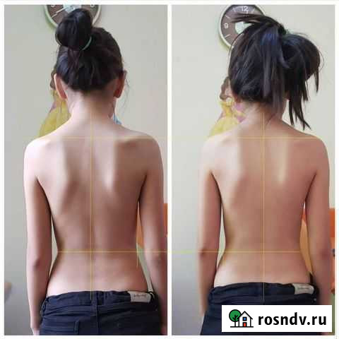 Выездной Мануальный терапевт Массаж Костоправ Муром - изображение 1