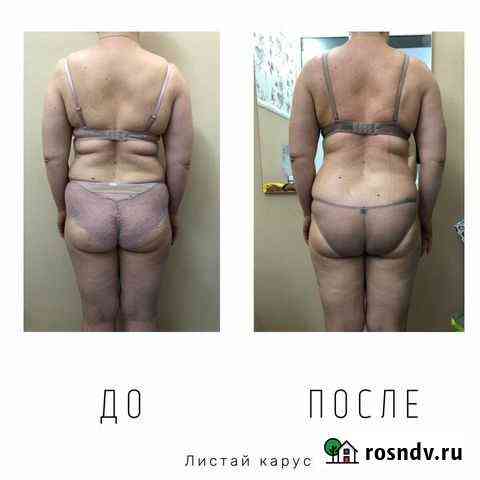 Массаж Калининград