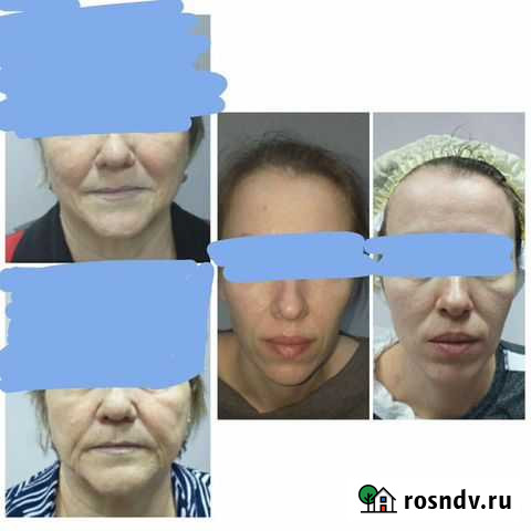 Косметолог.Бесконтактное омоложение Красноярск - изображение 1