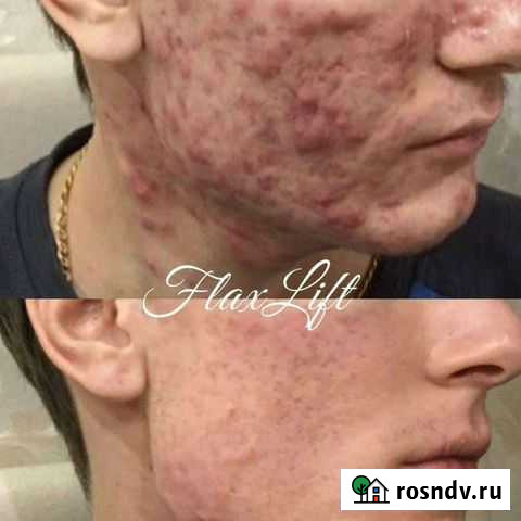 Косметолог-эстетист/чистка лица/ламинирование ресн Мурино - изображение 1