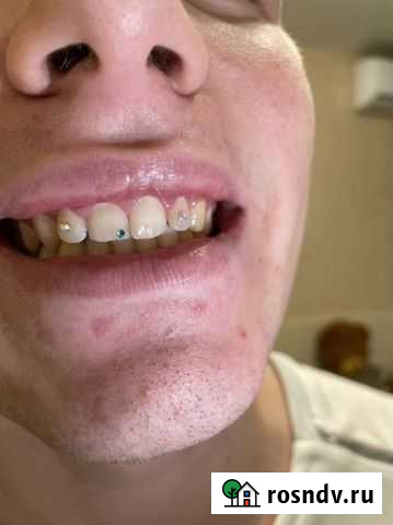 Установка скайс Краснодар - изображение 1