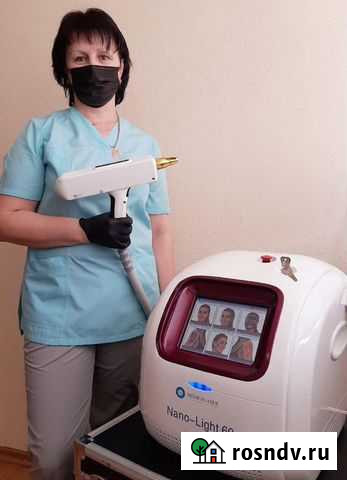 Удаление татуировок Омск - изображение 1