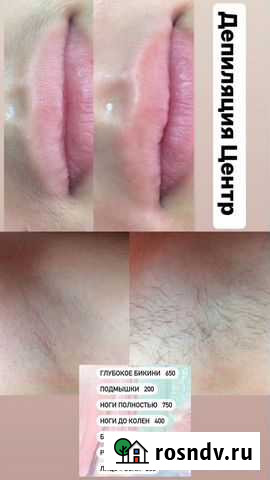 Депиляция в центре Уфы Уфа - изображение 1