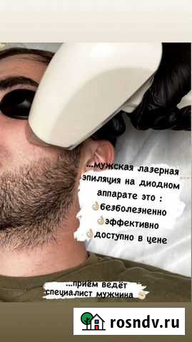 Лазерная эпиляция для мужчин Махачкала - изображение 1
