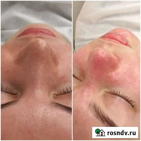 Услуги Косметолога Ульяновск - изображение 1